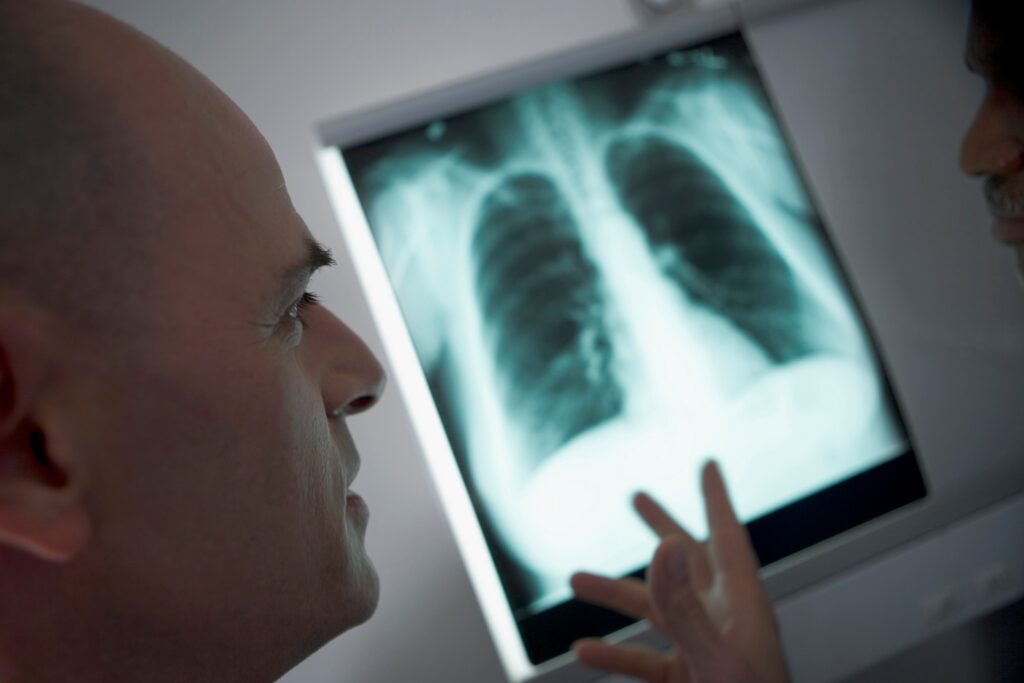 Mężczyzna pracownik służby zdrowia patrzący na zdjęcie rentgenowskie, z ręką osoby po stronie obrazu