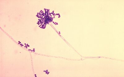 Aspergillus fumigatus pod mikroskopem