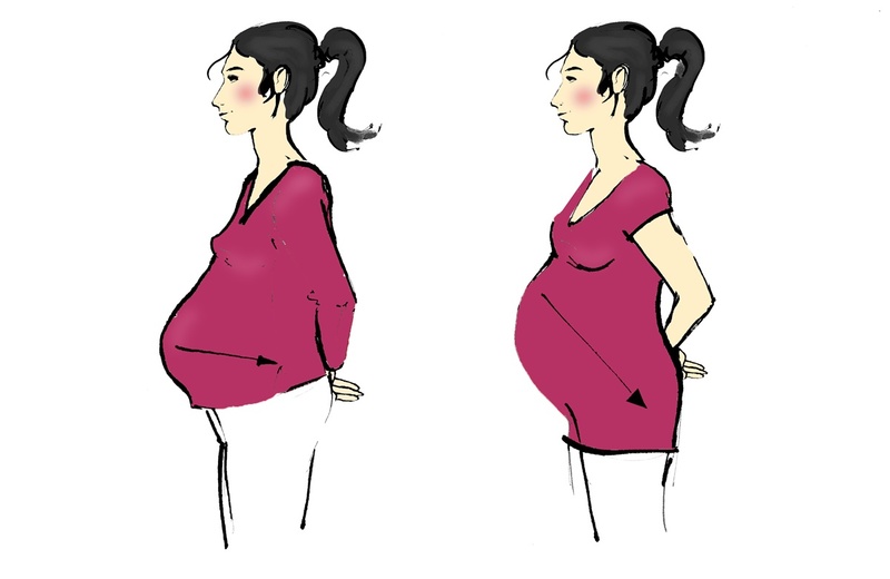 Rys. 1. Kształt brzucha kobiety w trakcie ciąży; A: bez przygotowania mięśni głębokich, B: po wcześniejszym przygotowaniu mięśni głębokich; dostęp online https://rmpb.pl/ tematy/brzuch-w-ciazy-anatomia-i-fizjologia